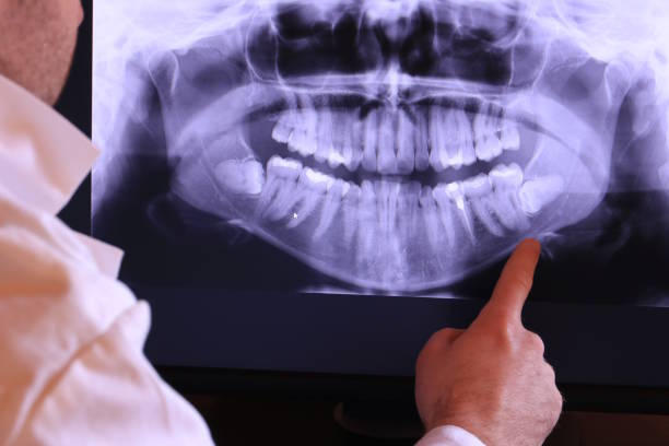 Best Emergency Tooth Extraction in Naco, AZ
